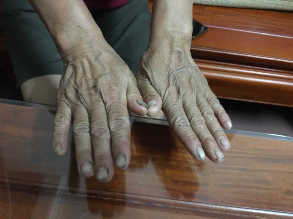 mẹ đã nuôi mình “lớn”